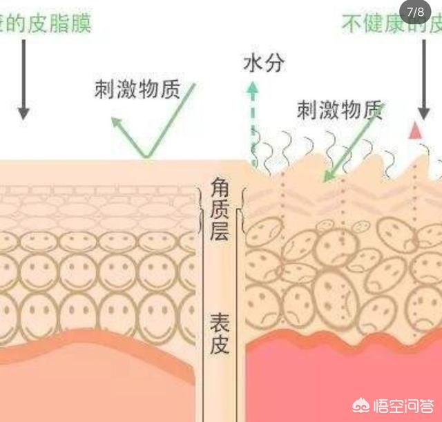 痘痘肌女孩怎样才能养成不长痘的肤质？