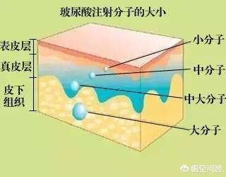 注射的玻尿酸被吸收后，皮肤会松弛吗？