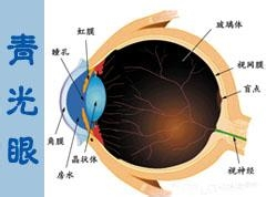 营销近视症(营销近视症的负面影响)